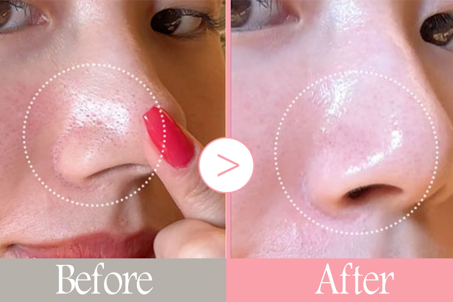 Nouelv Salmon DNA PDRN Pink Collagen Jelly Pads – Korean Wet Compress Toner Pads