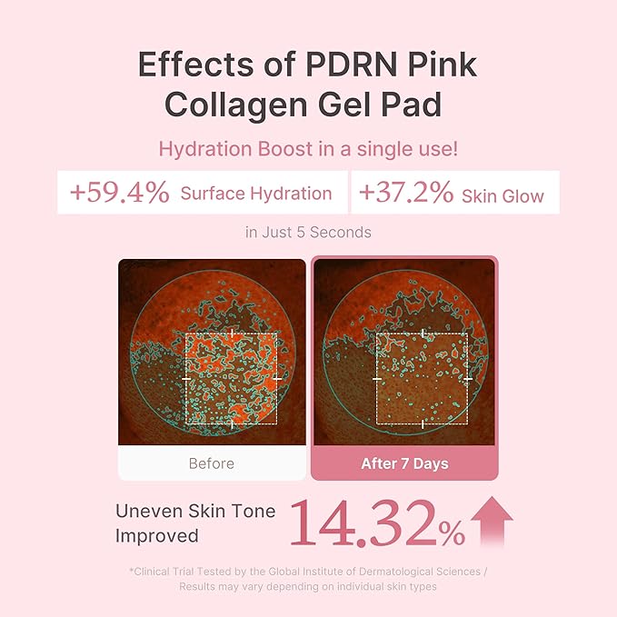 Nouelv Salmon DNA PDRN Pink Collagen Jelly Pads – Korean Wet Compress Toner Pads